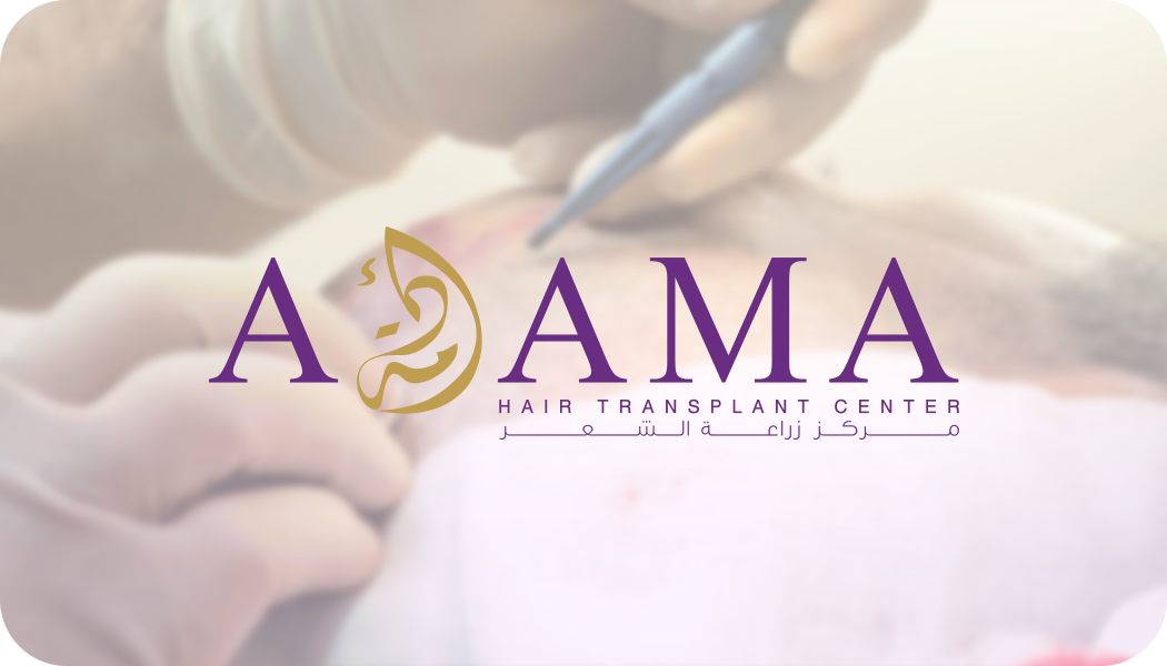 مركز أدمة لزراعة الشعر